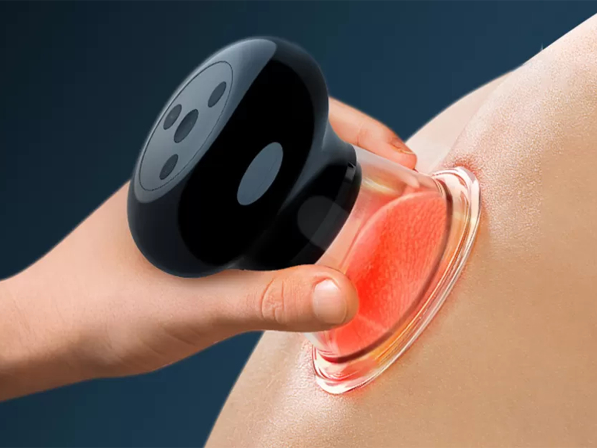 Modern Electric Cupping vs Traditional Fire Cupping: Key Differences for Modern Wellness Users